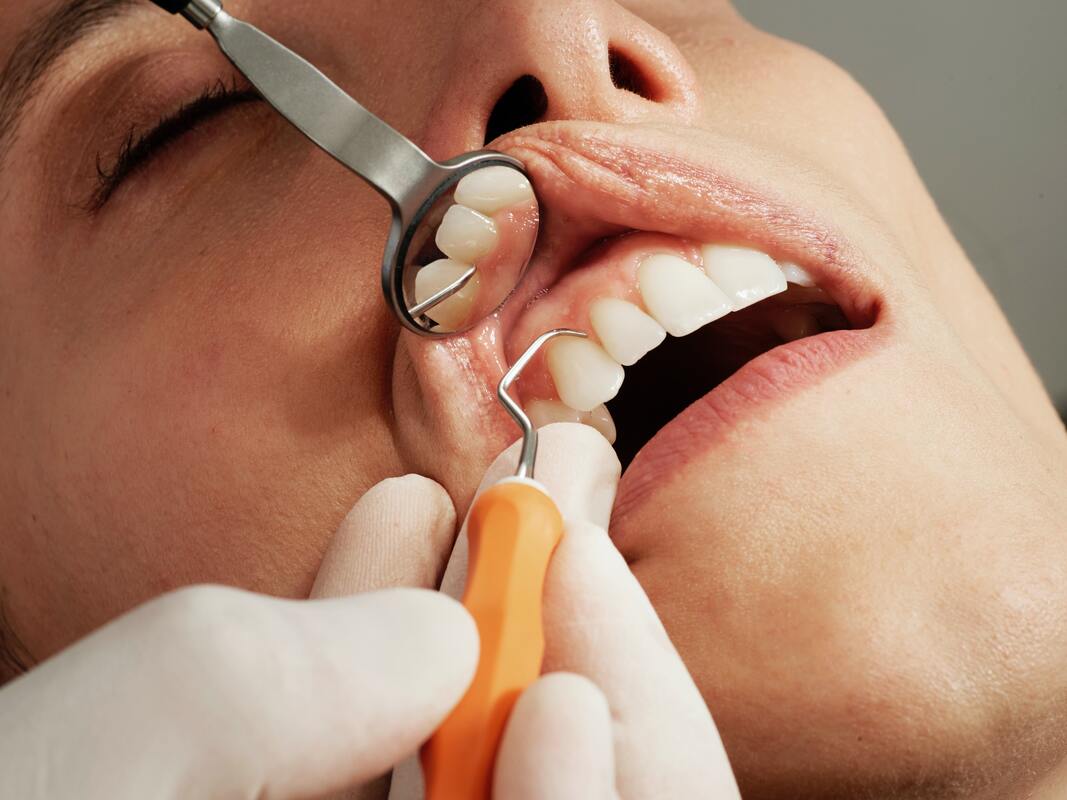 woman in a dental procedure